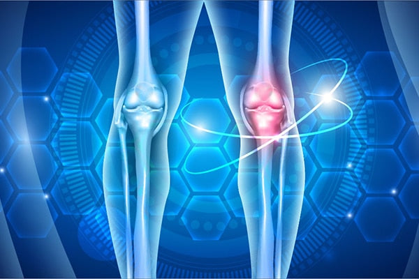 How CBD Can Safely Help Relieve Arthritic Pain