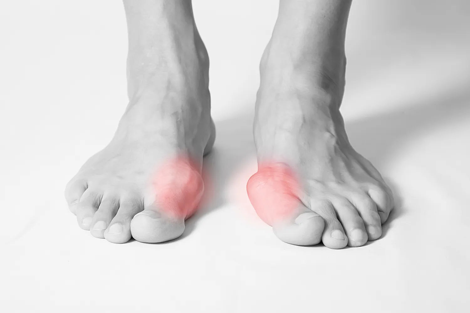 Bunion Pain: Causes & How To Get Relief