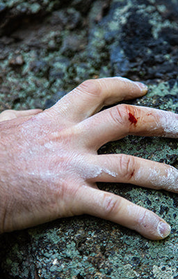 Accelerating Recovery: How CBD Can Aid Climbers in Overcoming Finger Injuries
