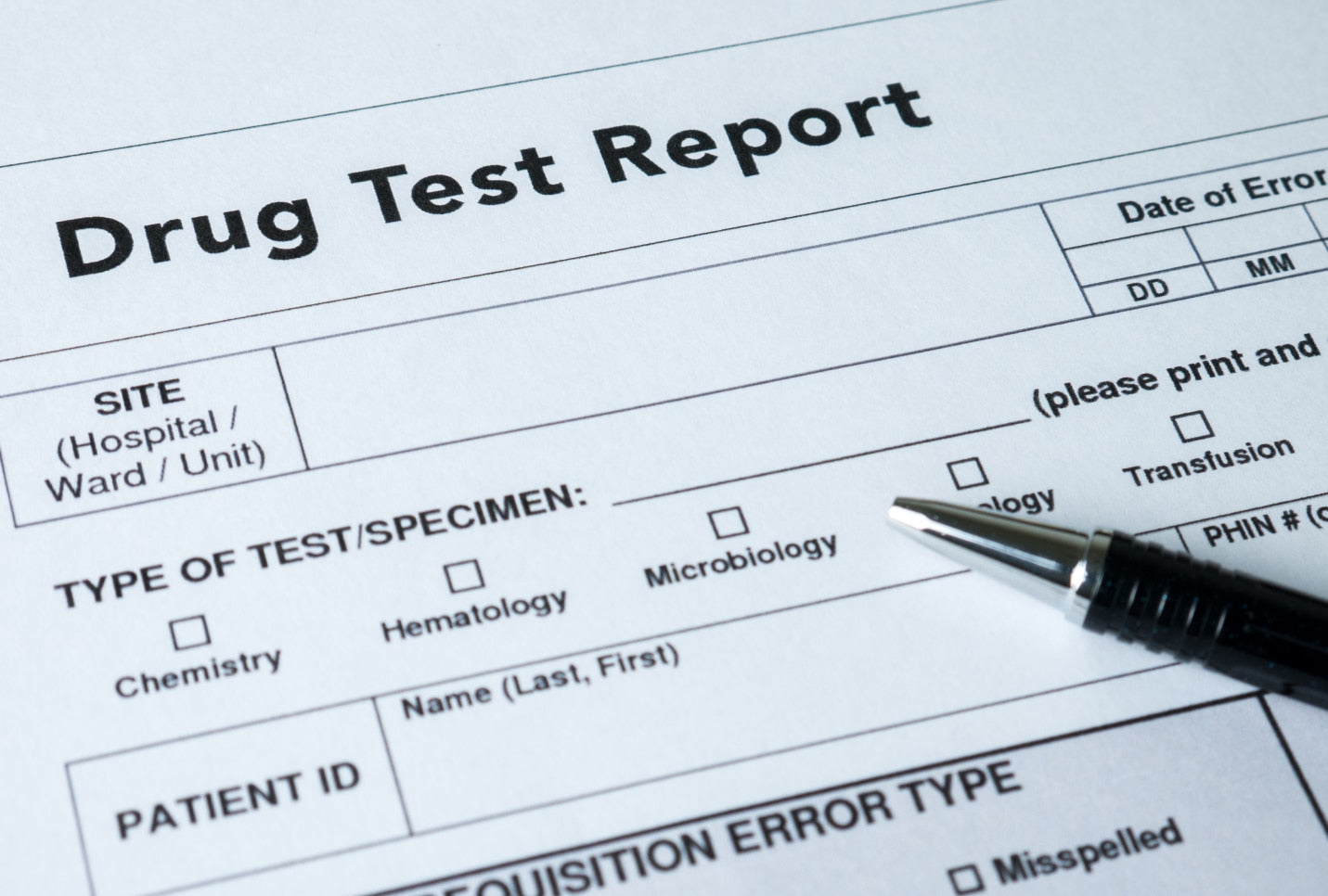 Does CBD Show Up on a Drug Test?